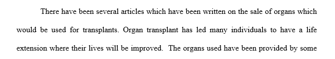 Refute the claim that people should be able to buy organs for transplant if they would not be able to receive an organ by waiting their turn 