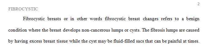 It's not at all uncommon to have fibrocystic breasts. 